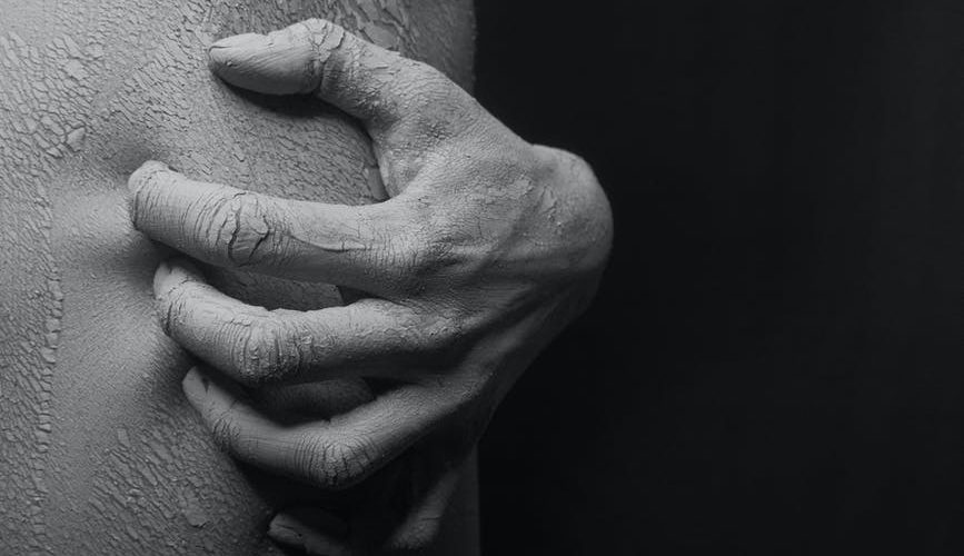 close up photo of a person s hand scratching on his flaky skin in black and white